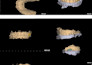 exocad design esthetic veneers, crowns, implants